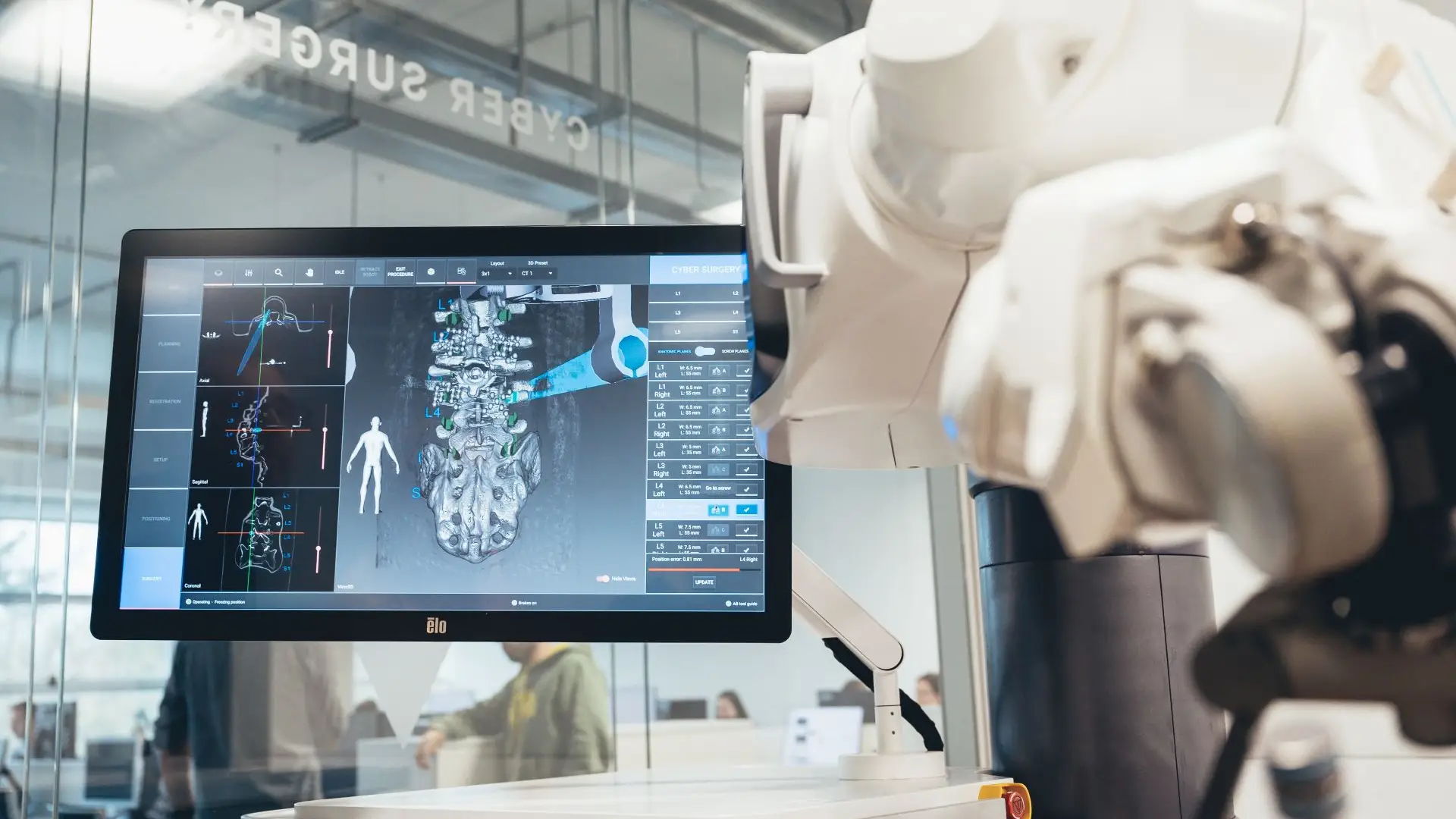 Asistente robótico ALAYA de Cyber Surgery en quirófano durante cirugía de fusión vertebral